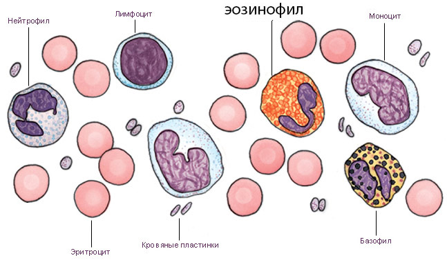 Еозинофіли підвищені відносно норми: причини патології, як знизити