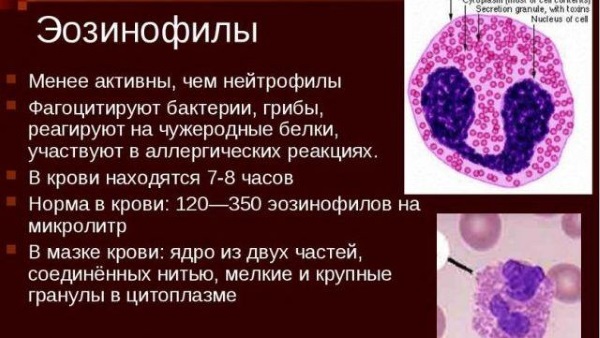 Еозинофіли підвищені відносно норми: причини патології, як знизити