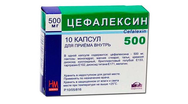 Етмоїдит його різновиди лікування гострої та хронічної стадії