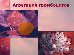 Еуфілін для інгаляцій в небулайзере: інструкція