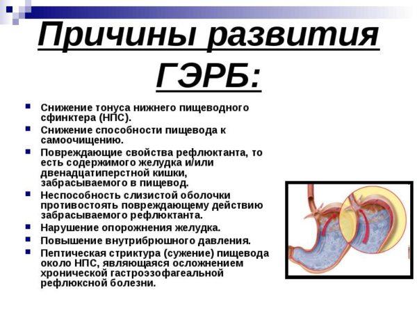 Езофагіт і трави лікування народними засобами