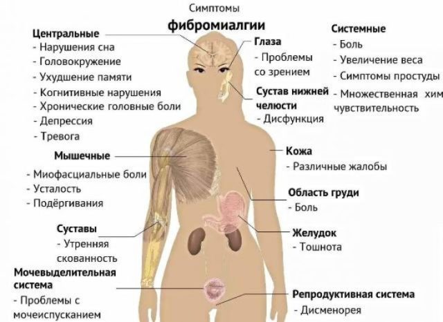 Фіброміалгія лікування народними засобами