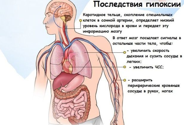 Фіброз легенів симптоми методи діагностики терапії та профілактики