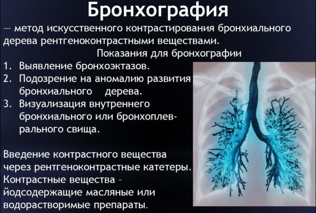 Фіброз легенів симптоми методи діагностики терапії та профілактики