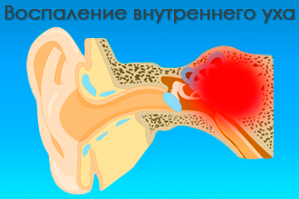 Фарингіт температура головний біль – Біль у голові