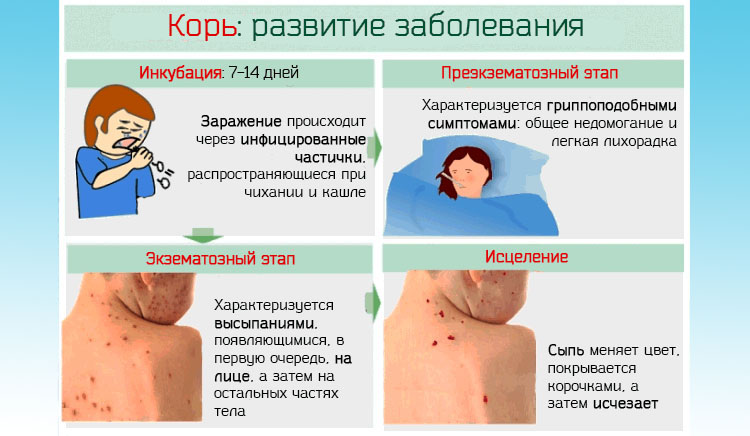 Фаринголарингит у дорослих як проявляється і методи його лікування