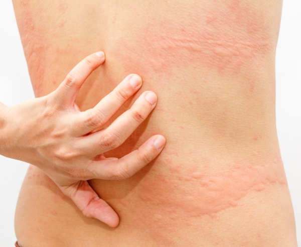 Фарингосепт відгуки інструкція по застосуванню. Інструкція по застосуванню Фарингосепта: від чого допомагає