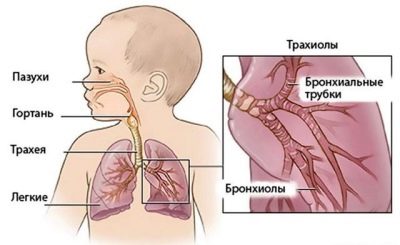 Флуімуціл – антибіотик ІТ: інструкція по застосуванню, ціна та відгуки. Як розводити для інгаляцій