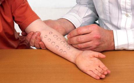 Форми вазомоторного риніту його симптоми і лікування у дорослих