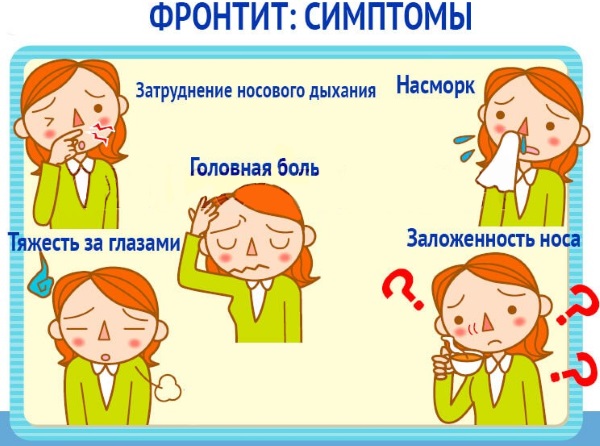 Фронтит симптоми діагностика лікування