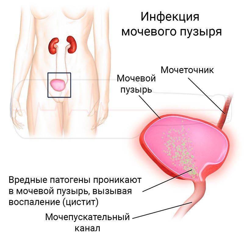Фурадонін з алкоголем — schket Фурадонін з алкоголем — schket
