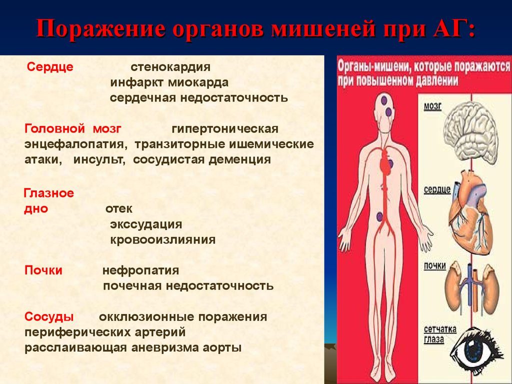 Гіпертонічна хвороба 3 стадії 3 ступеня ризик 4: що це таке