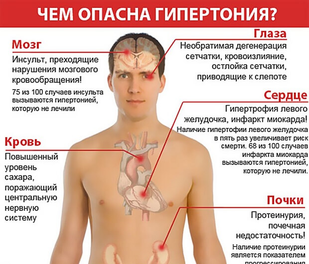 Гіпертонічна хвороба 3 стадії 3 ступеня ризик 4: що це таке