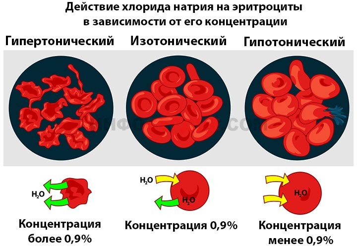 Гіпертонічний розчин солі приготувати і застосовувати