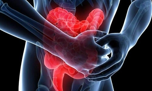 Гази в кишечнику причини і як позбутися