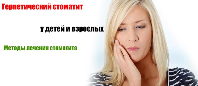 Герпетичний (герпесный) стоматит у дорослих: симптоми і лікування