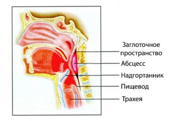 Головний біль і біль у горлі: можливі причини недуг
