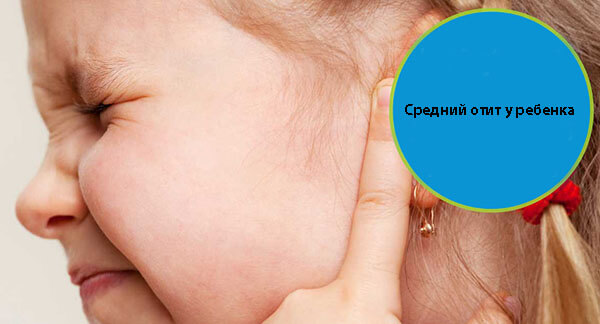 Гострий катаральний середній отит у дитини