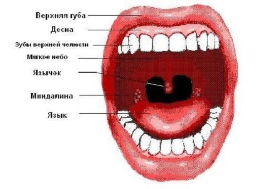 Гострий тонзиліт – причини, симптоми і лікування гострого тонзиліту