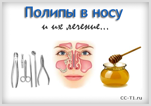 Хірургічні способи видалення поліпів носа у дітей