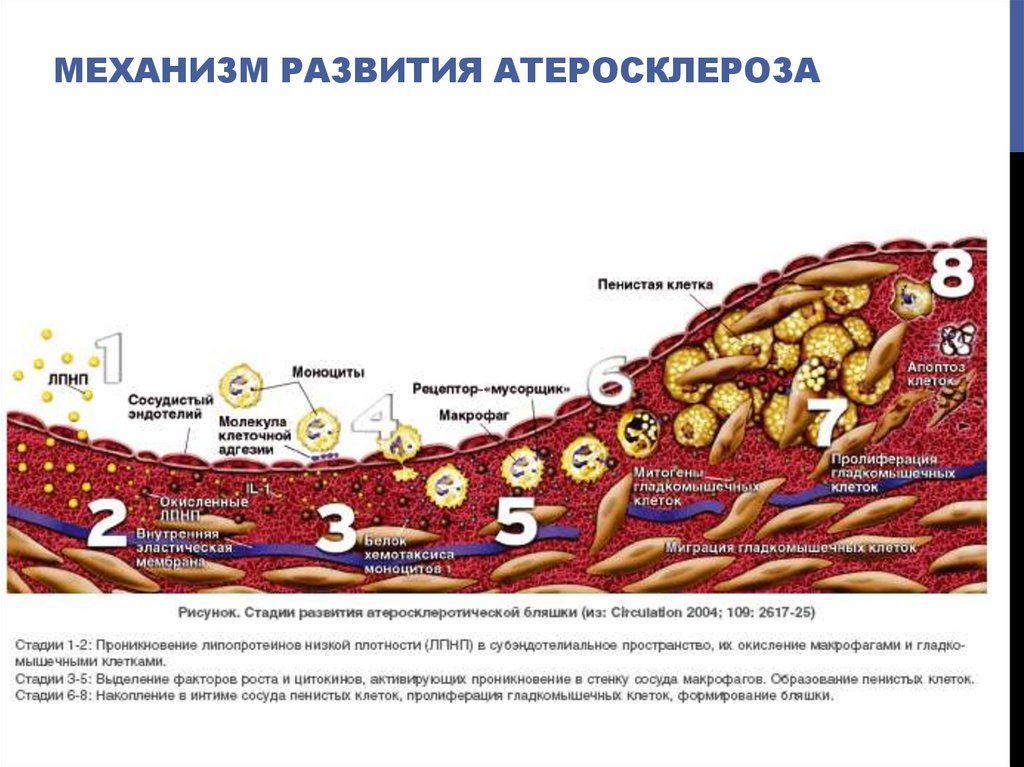 Холестеринові бляшки в судинах шиї лікування народними засобами