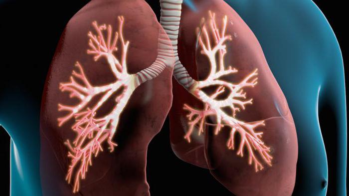 Хронічна обструктивна хвороба легень (ХОЗЛ)