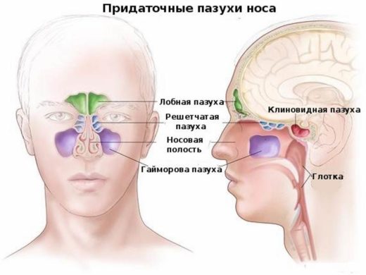 Хронічний гайморит причини симптоми і лікування та профілактика