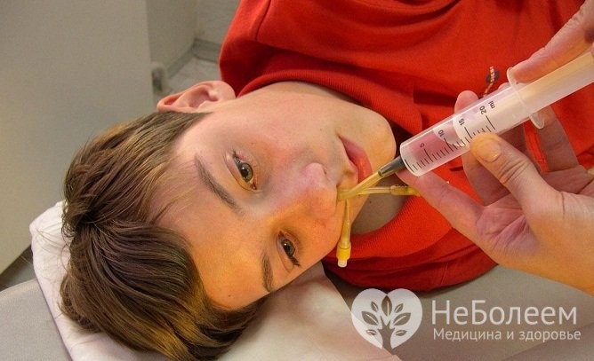 Хронічний гайморит – симптоми, лікування у дорослих і дітей