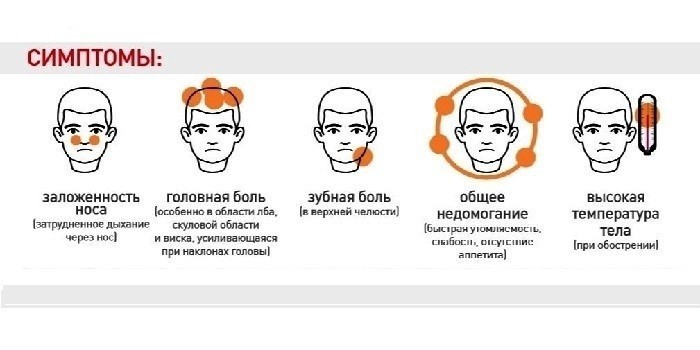 Хронічний сфеноидит – що це таке? Сфеноидит: симптоми, діагностика та лікування