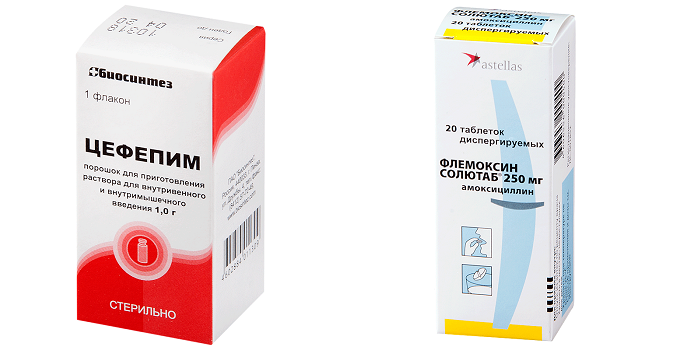 Хронічний сфеноидит – що це таке? Сфеноидит: симптоми, діагностика та лікування