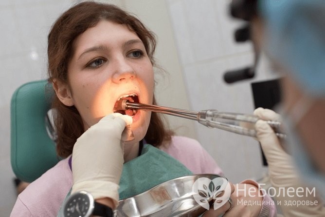Хронічний тонзиліт у дорослих причини і методи лікування