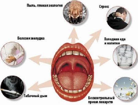 Хронічний тонзиліт у дорослих причини і методи лікування