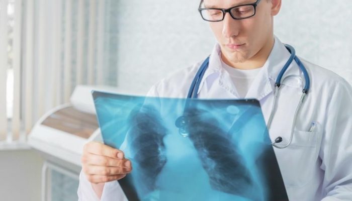 Хто такий лікар-фтизіатр що він діагностує і лікує Хто такий лікар-фтизіатр що він діагностує і лікує