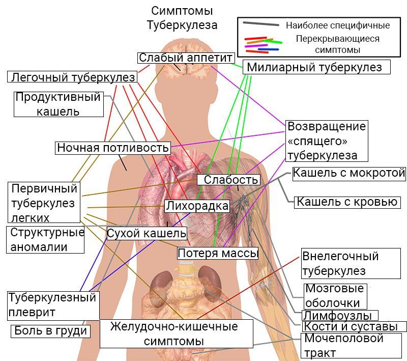 Хто такий лікар-фтизіатр що він діагностує і лікує Хто такий лікар-фтизіатр що він діагностує і лікує