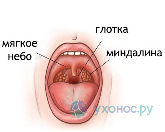 Хворе горло без почервоніння