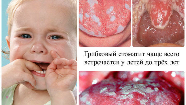 Хвороби горла та гортані: які бувають (список), симптоми і лікування