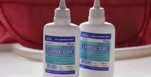 Хвороби зубів і ясен лікуємо в домашніх умовах