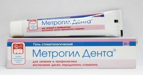 Хвороби зубів і ясен лікуємо в домашніх умовах