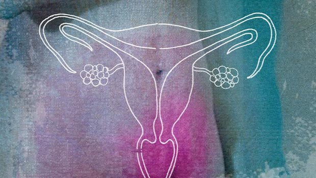 Интерстициально субсерозная міома матки: що це таке, як лікувати субмукозную форму захворювання у жінок Интерстициально субсерозная міома матки: що це таке, як лікувати субмукозную форму захворювання у жінок