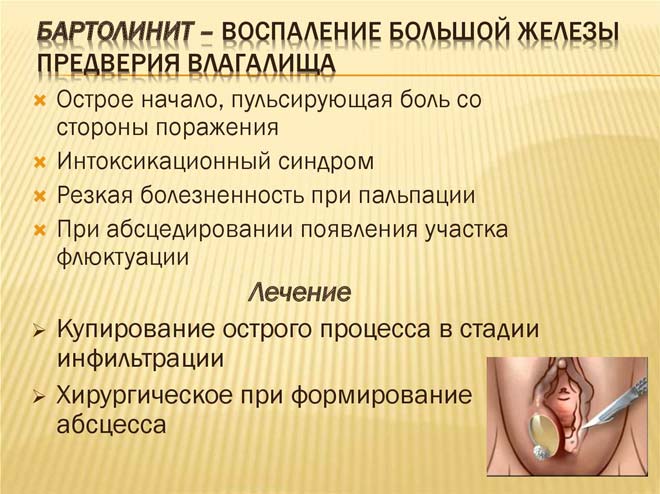 Кіста бартолиновой залози в яких випадках лікують а в яких видаляють