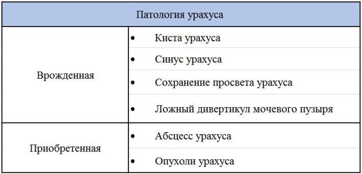 Кіста сечового міхура або як е називають медики кіста урахуса