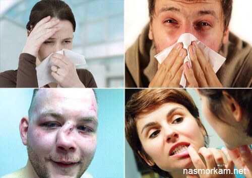 Кіста в носі – лікування народними засобами без операції, що робити?