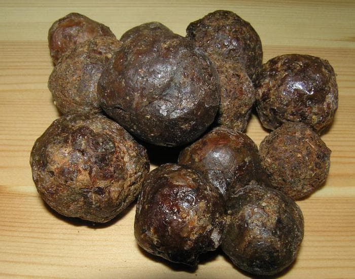 Кісточка на нозі – як лікувати народними засобами