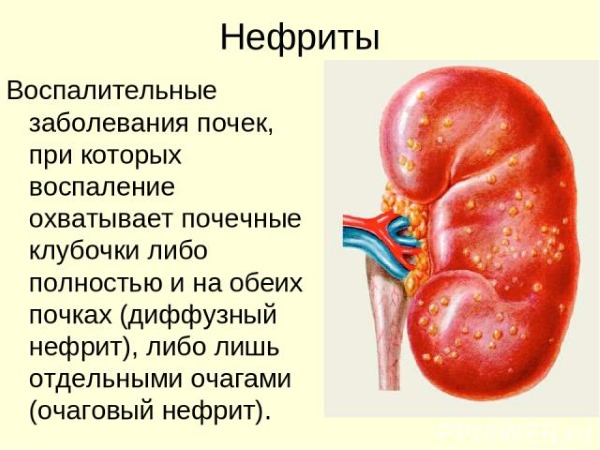 Корисні лікувальні властивості алое та протипоказання застосування соку алое