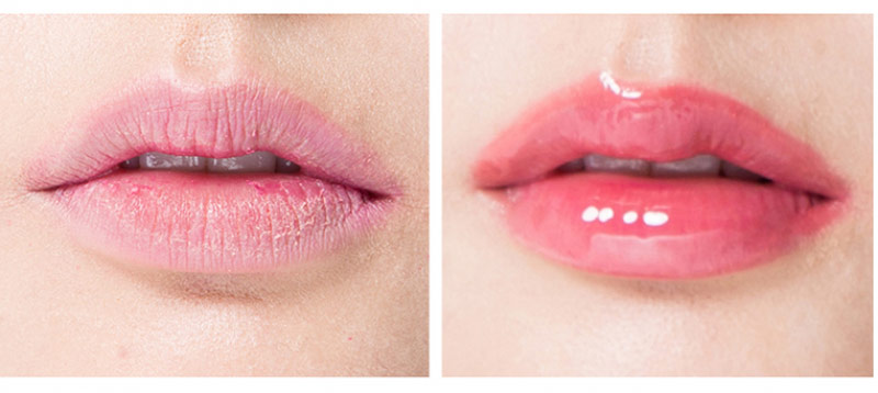 Користь олії меліси для шкіри, Чим ефект?