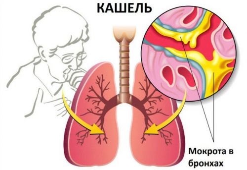 засоби для дітей від кашлю – вибираємо з розумом засоби для дітей від кашлю – вибираємо з розумом