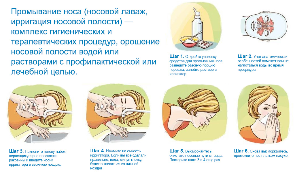 Краплі в ніс з цикламеном: аптечні і народні засоби. Краплі з цикламеном від гаймориту назва краплі з цикламеном