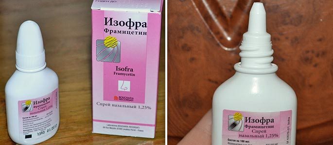 Кращі спреї від гаймориту у дорослих