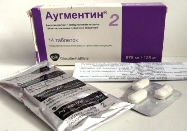 Ліки від гаймориту – кращі препарати та ефективні засоби Ліки від гаймориту – кращі препарати та ефективні засоби