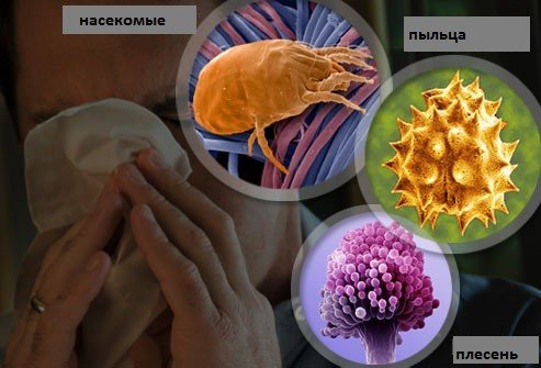Лікування алергічного нежитю: огляд сучасних методів